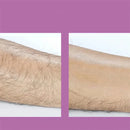 Épilateur Féminin sans Douleur